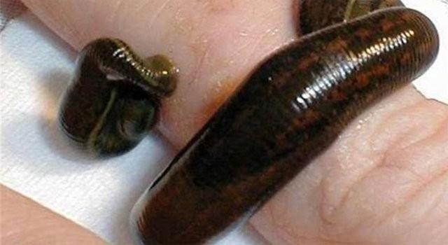 Slk Toplayc: Baz hastalklarn tedavisinde iyi geldii sylenen slkleri toplayp, doktorlara satan kiilerdi.