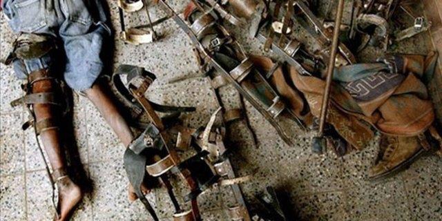 Buna engel olmak iin yaplan bu ekmek frn benzeri alet mekanik bir akcier olup, ocuklarn nefes alp vermesine yardmc olmaya alsa da bu makinede aylarca yaayan ocuklarn hemen hepsi hayatn kaybetmitir.