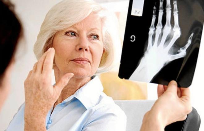 DAHA GL KEMKLER<br>  Dzenli yeil ay tketimi kemik yapmn uyarmaya ve kemik ykmn yavalatmaya yardmc olur.