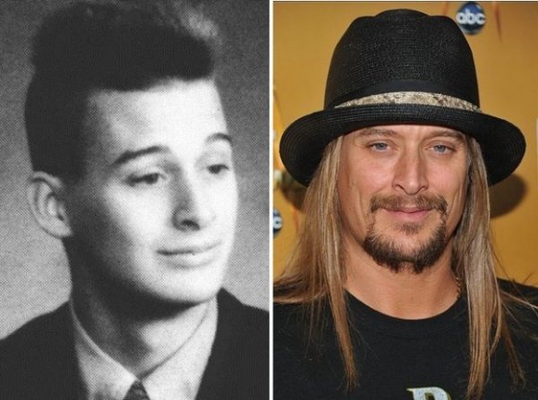 Kid Rock