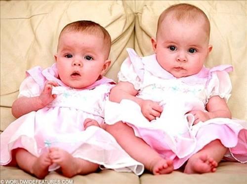 <p><b>Neden tek yumurta ikizlerinin parmak izleri birbirini tutmuyor? </b<</p>  Tek yumurta ikizleri ayn DNA'ya sahip olsalar da hcre-hcre ayn deildir, d grnnz genleriniz belirlemez. Parmak izleri ise vcutta maruz kalnan hormonlara baldr. ki hcrenin hormon seviyesi farkl olduu iin, parmak izleri de ayn olmaz