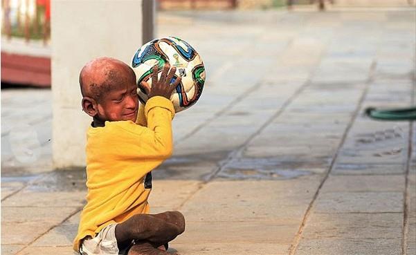 Amele olarak alan ve ayda 7.000 Nepal rupisi (185 TL) kazanan baba Nanda, olunun ar tedavi masraflarn karlayacak mali gce sahip deildi. Nanda bu durumu u szlerle dile getirdi: "Ramesh'i blgemizde bulunan baz doktorlara gtrdk. Doktorlar bize tedavinin ok masrafl olacan ve sadece zel hastanelerin gerekli tedaviyi sunabileceini sylediler. Yeterli paramz yoktu ve baka aremiz olmad iin olumu evde tutarak elimizden gelenin en iyisini yapmaya altk."