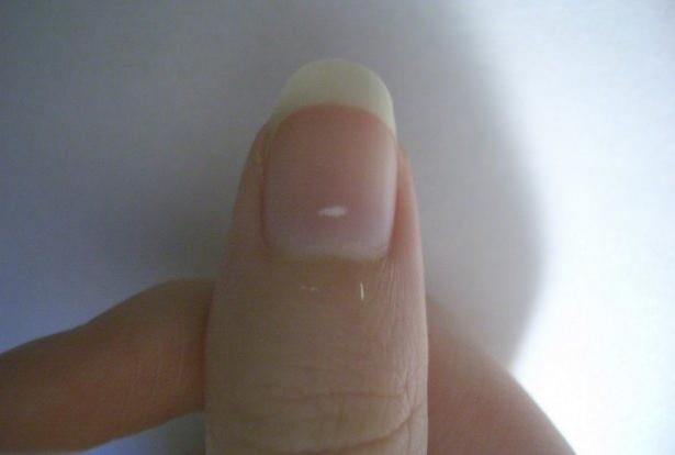 Trnak batmalar baz ilalarn yan etkileri Nefrit.