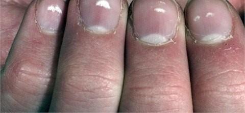 te bu hastalklardan sadece bir ka...