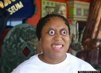 <p><b>Patlak gz Jalisa</b></p>    Thompson Ripley'in 'Believe It Or Not' (ster nan ster nanma) ad altnda sergiledii koleksiyonunda dnyann en nl 'tuhaflar' da boy gsterdi. Patlak gz Jalisa Thompson 500 dolarlk dln sahibi oldu. Koleksiyonunu bugne kadar 10 lkede at 27 sergi ile halkla paylaan lgn koleksiyoncu Robert Ripley, modern Indiana Jones olarak da tannyor. ABD'li Ripley, yllardr dnyay dolaarak insanlarn imdiye kadar karlat en 'garip' nesneleri topluyor.