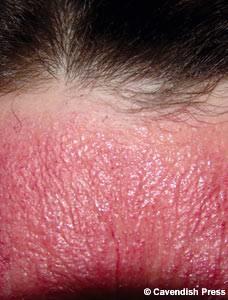 nk Bird'n 21. yy'a ait olan tm teknolojilere alerjisi var. Spa mdr olarak alan Bird, eer teknolojik dalgalara yaklarsa cildi biranda kzarmaya ve gzleri imeye balyor. Bu yzden salkl olabilmek iin evinde teknolojik aletlerin hibirisi bulunmuyor.