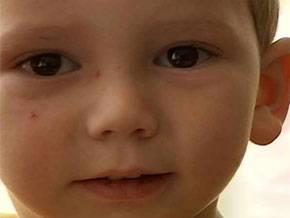 <p><b>O Hi Uyumuyor</b></p>     Rhett Lamb 3 yandaki her ocuk gibi biraz yaramaz ve huysuz . Ama onu dier yatlarndan ayran ok nemli bir zellii var. O doduundan beri uyumuyor. Evet doru duydunuz , bu ocuk yllardr gzlerini hi krpmyor bile.