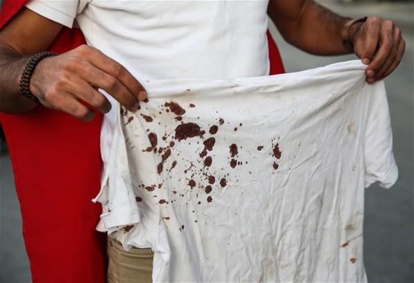 Fetullah Terr rgtnn (FET)  darbe giriiminde, Boazii Kprs'ne giden ve vatandalarn ehit olmasna,  yaralanmasna tank olan Siirtli Mushap Karakoyun, tirtndeki ehit kanyla  Cumhurbakan Recep Tayyip Erdoan'n konutunun bulunduu Kskl'daki "demokrasi  nbeti"ne katld.