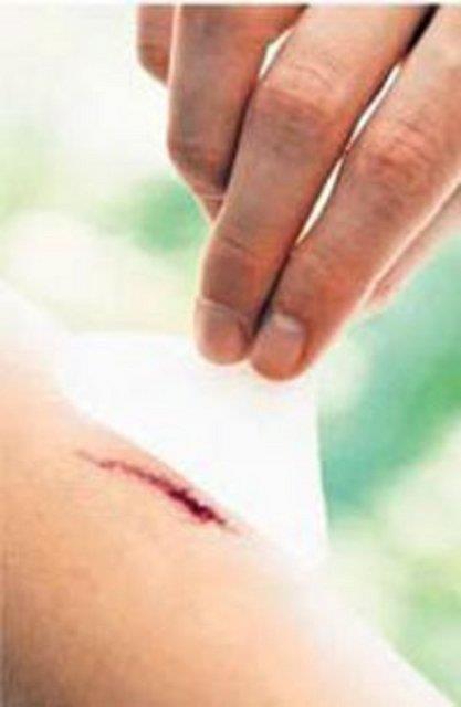 Bir saniyeden ksa srede yaralanan blgedeki damarlar kan akn durdurmak iin daralyor.