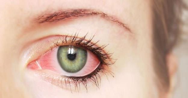 Tkrk, gzya ve ter bezleri, genital organlardaki d salg bezleri, pankreasn d salg blm gibi yerlerde gelien iltihap sonucu oradaki bezlerin grevlerinde aksamalar balar.