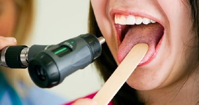 Bu hastalk bir kanser deildir. Ancak, hastaln seyrinde B lenfosit olarak bilinen baz kan hcrelerinden kken alan lenf kanserine yatknlk artmtr.