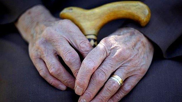 Alzheimer, ya ilerledike unutkanlkla ortaya kan, hafza, konuma gibi durumlarda sorunlar yaanan, gnlk yaamn gereklerini uygulayamama gibi problemlere yol aan bir hastalk olarak tanmlanyor.