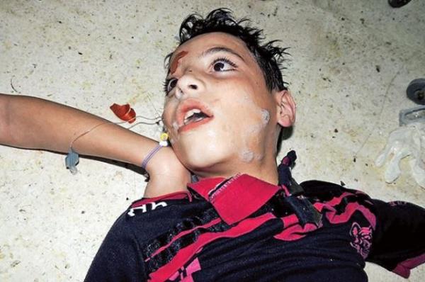 1991'de Birlemi Milletler tarafndan kitle imha silahlar kategorisine alnan sarin gaznn retimi ve depolanarak saklanmas 1993'te CWC (Kimyasal Silahlar Konvensiyonu) tarafndan yasakland.