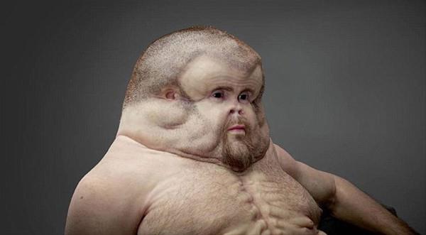 'nsan vcudu geirdii trafik kazalarndan sonra kendi kendini koruyabilmek iin evrimleseydi ne olurdu?' sorusundan yola kan sanat Patricia Piccinini  ilgin bir almaya imza att.