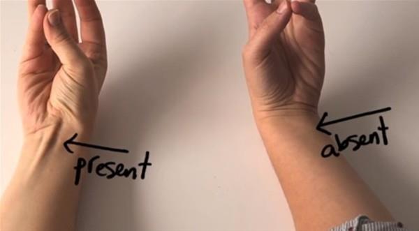 nsanlk kollaryla bylesine ar ileri yapmay brakt brakal kas ilevini kaybetmi, bazlarmzda ise tamamen yok olmu durumda.