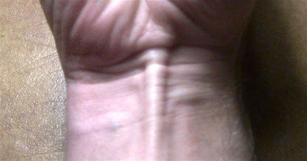 nsanlk kollaryla bylesine ar ileri yapmay brakt brakal kas ilevini kaybetmi, bazlarmzda ise tamamen yok olmu durumda.