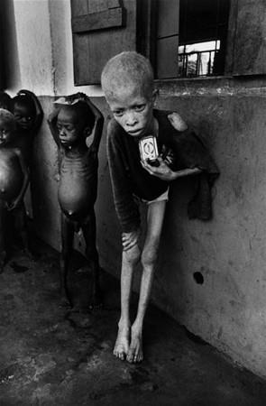Albino ocuk, Biafra - Don McCullin (1969)