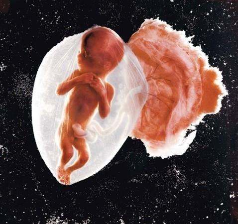 18 haftalk Fets - Lennart Nilsson 1965