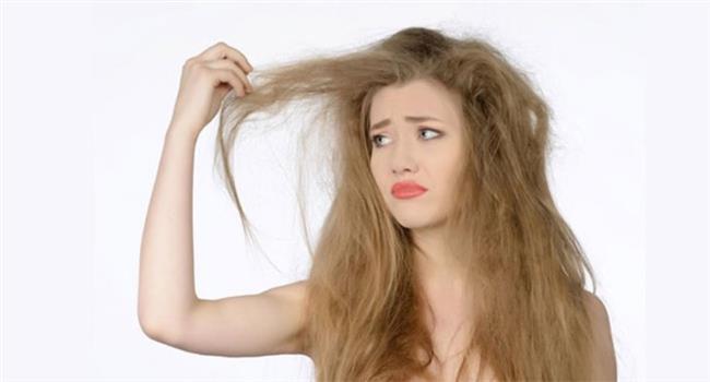 San ekillendirilmesi