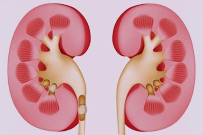 Kahvenin yannda su imenin yan sra, bbrek tann nne gemek iin u admlara dikkat etmek gerekir...