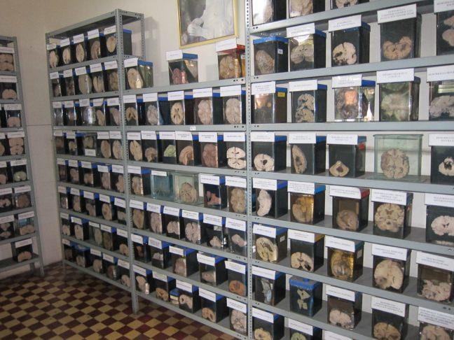 Peru&#8217;nun Lima kentinde bulunan Beyin Mzesi, bal bulunduu hastane sayesinde 2.912 salkl ve hastalk geirmi beyin toplam.