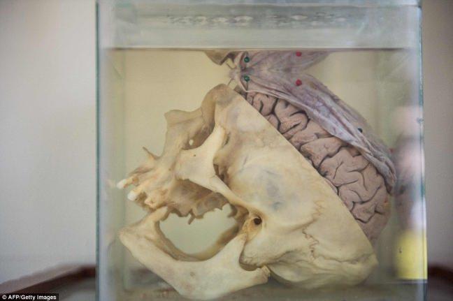 Ziyaretilerle beyinler arasnda yalnzca bir kavanoz cam var. Hastalklarn beyine etkilerini btn gereklikleriyle grebiliyorlar. Gerek kafataslarnn da bulunduu alana geldiklerinde ise isterlerse kafataslarna ve dier kemiklere dokunabiliyor, inceleyebiliyorlar.