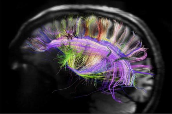 <p><b>Glukoz lensleri</b></p>  Yeni kontak lensler zellikle eker hastalar iin gelitirildi.