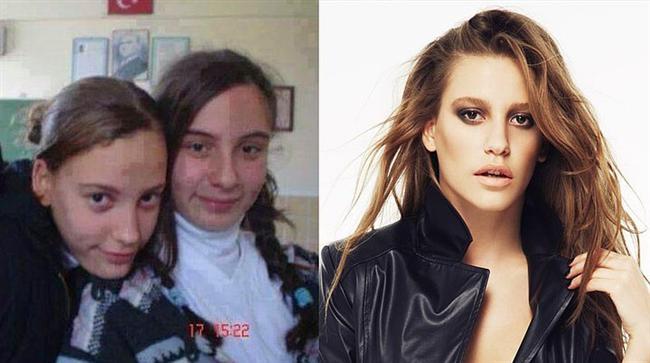 Umudunuzu kaybetmeyin! Siz de zaman ierisinde onlarn geirdii deiimi yaayarak mthi grnebilirsiniz. te nllerin nasl deitiini gsteren 19 fotoraf!