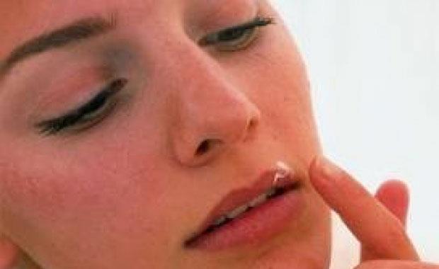 Columbia niversitesi&#8217;nde yaplan bir aratrmaya gre, uuk ve Alzheimer ve bunama arasnda bir balant var.  8 yl boyunca 59 ve 79 yalar arasndaki insanlar zerinde yaplan aratrmada, Tip 1 ve Tip 2 herpes simpleks (uuk) virsne maruz kalanlarn hafzasnn daha da ktletii tespit edildi.