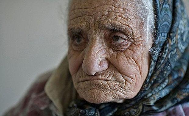 Baka bir ilgin gerek de, ciltteki krklklarla ilgili.