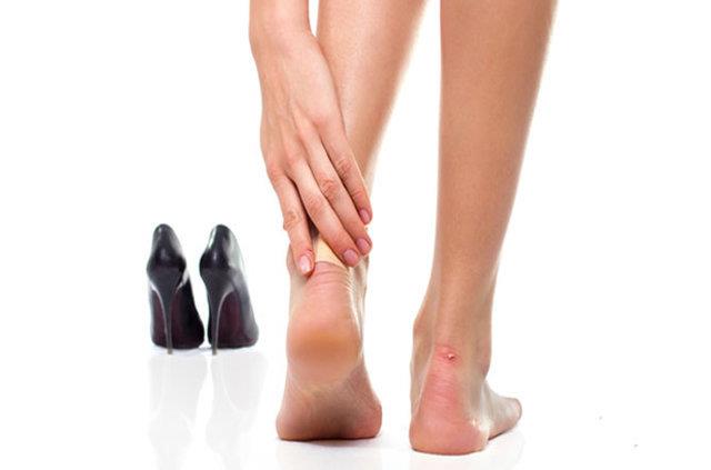 Vurmasndan endie ettiiniz bir ayakkab giyecekseniz nce salam bir yara bandn topuklarnza yaptrarak nlem alabilirsiniz. Evet ok klasik bir yntemdir ama koruyuculuu yksektir.