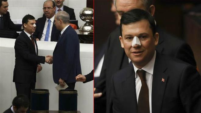 ahin'in makam aracnn gideri 32 bin 164 TL.