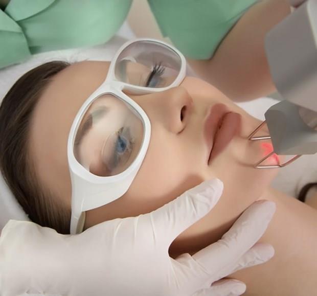 neli radyofrekans: neli radyofrekans, derinin st tabakasnda hasar oluturmadan, dermis tabakasnda kolajen ve elastik dokunun artn salyor. Bylece krklklar ve mevcut izler azalyor, cilt uzun sreli sklayor. nelerin uzunluu, istenen derinlie gre ayarlanabiliyor. Uygulama genellikle bir ay aralklar ile 2-4 seans yaplyor.