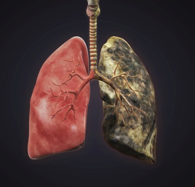 Smoker's Lungs<p>  Sigarann ne kadar zararl olduunu hepimiz biliyoruz. indeki o zehir akcierleri mahvediyor. Bu kadar kt olan eyin bir de nasl gzktn izlemek hi de ho deil. Simsiyah bu grntnn akcier olduuna ilk bata inanmayabilirsiniz.