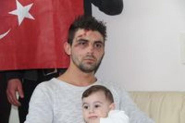 Trkiye'nin Rotterdam Bakonsolosluu nnde Aile ve Sosyal Politikalar Bakan Kaya'ya destek iin toplananlar arasnda bulunan Trk vatanda Kurt, Hollanda polisinin iddetine maruz kald