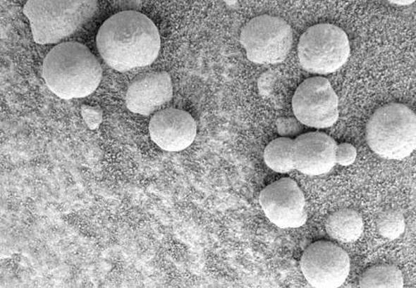 Fotoraftaki obje ilk bakta Ortaa&#8217;da kullanlan glleleri hatrlatyor. Beynimiz, fotoraftaki nesnenin insan yapm (Ya da belki de uzayl yapm!) bir top olduunu bize sylese de, muhtemelen bu yalnzca, inanlmaz aamalardan geerek olumu normal bir kaya.