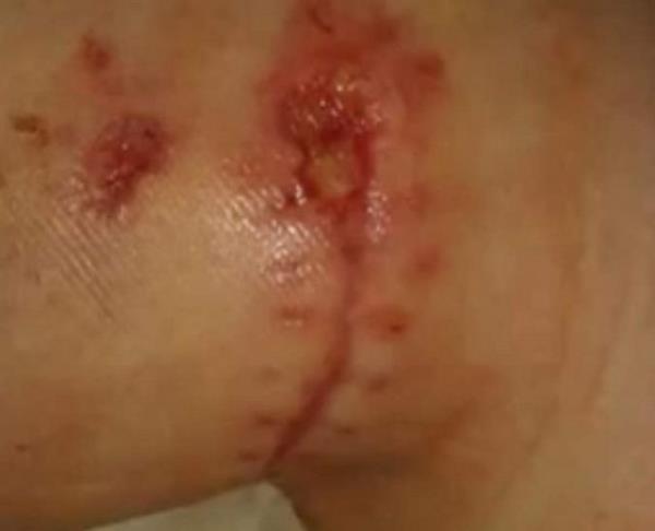 Brennan ilk mdahale Tayland'da yapldktan sonra lkesine dnd. Hl yardm almadan yryemeyen Brennan, "eri girerken bana kaplanlarn insanlara alk olduu ve hibir ey yapmadklarnn garantisi verildi ama yle olmad" dedi...