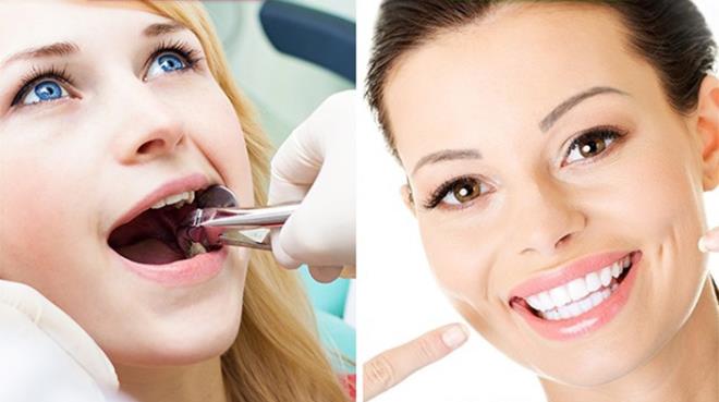 8- 20&rsquo;lik diimi &ccedil;ektirmek zorunda mym?<br /> &nbsp;  20&#8217;lik dileri salkl karsa ektirmenize gerek yok.