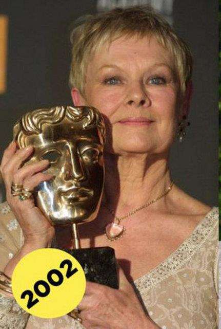 Amerikan basnndan Buzfeed sitesi son 10 yl iinde neredeyse hi deimeyen nl yldzlar aratrd. Yakkll ya da gzellii ile tannan bu isimler adeta yllara meydan okuyor. Hatta bazlarnn yalanmak yerine genletiini sylemek bile mmkn...