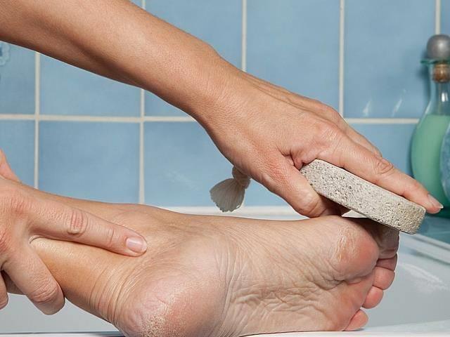 Ayaklarda, ellerde, bacaklarda, karnda ve gste imelere kar soan suyu imek etkili bir yntemdir. Gnde 3 kez yemekten nce 1 yemek ka soan suyu iin.