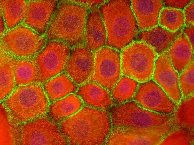 14. Her yl insan vcudu 2 kilo arlnda, yaklak 1 milyon cilt hcresi kaybediyor.