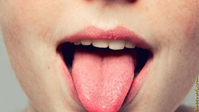 Dil kanseri tedavisinde radyoterapi uygulamalarnn gndeme gelmesi halinde ise boyun blgesi de nlanr ve kanserin ulaabilecei lenf nodlar, tedavi planna dahil edilir&#8221; ifadelerini kulland.