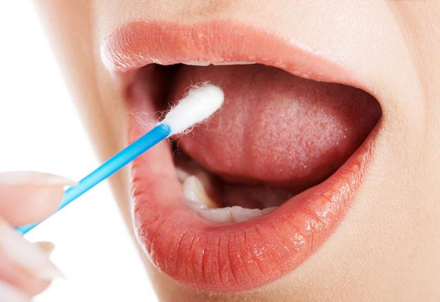 Dil kanserinin tedavisi planlanrken, boyun lenf nodlarnn da srece dahil edilmesi gerektiini kaydeden Alpay, "Cerrahi bir mdahale gndeme gelirse lenf nodlar da cerrahi srasnda karlmaldr.