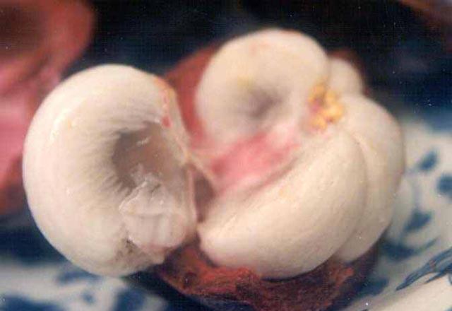 Serbest radikalleri engeller. Bylelikle vcudunuzda geliebilecek herhangi bir fiziksel ve zihinsel hastaln gelimesine engel olur.