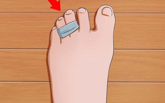 Bant kullanarak ayanzdaki nc ve drdnc parman birbirine yaptrn. Bu balama ilemi, ayak arnzn azalmasna byk lde yardmc olacaktr.