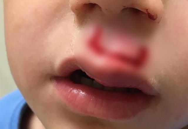 Sosyal meyda hesabndan ebeveynleri uyaran Harris,  basnl hava barndran stres arkalarnn kt sonulara neden olabileceini syledi.