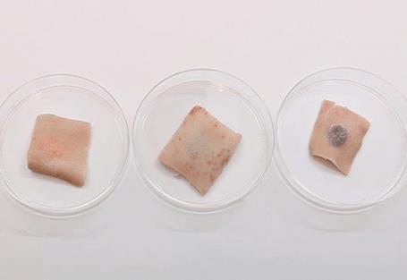 Yllar boyunca pek ok bilim adam, tbbi problemleri izlemek iin bir yntem olarak insan vcudunu dokunmatik ekrana nasl evireceini dnd, ancak bugne kadar kimse bu mtevazi dvmenin zm salayabileceini dnmemiti.