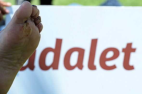 Adalet yryne katlanlarn ayaklarnda yry srasnda yaralar olutu.