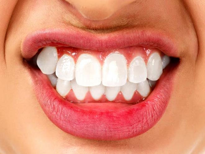 <strong>2. Muz kabuu dileri beyazlatr</strong>  Potasyum, magnezyum ve manganez olduka zengin olan muz kabuu dileri beyazlatmada ve di lekelerinin temizlenmesinde nemli rol oynar.