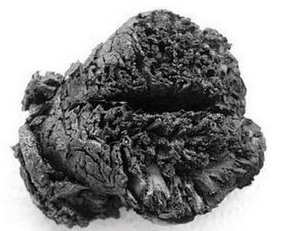 Bugne kadar bulunan en eski insan beyni... Yaklak 4000 bin yllk...